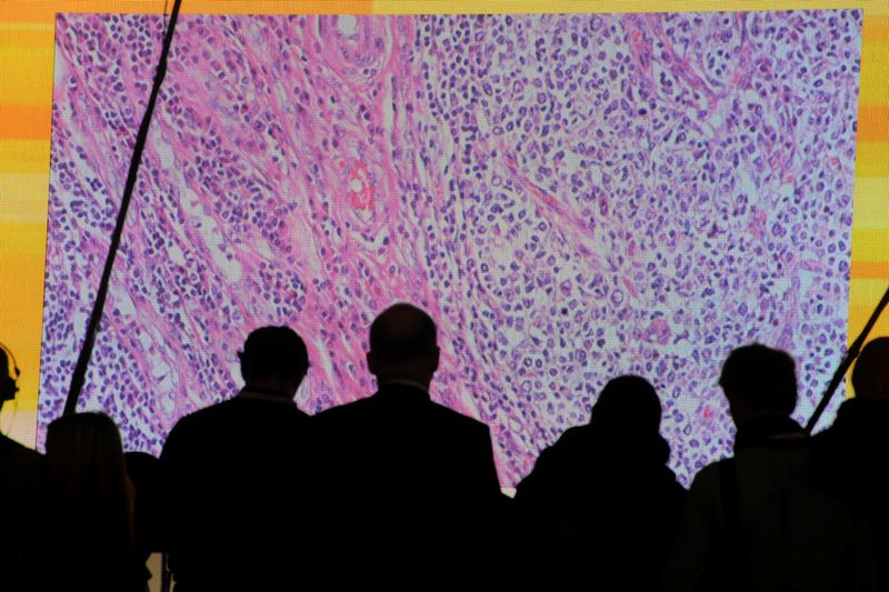 Health Rounds: Laser treatment before immunotherapy helps brain cancer patients live longer-