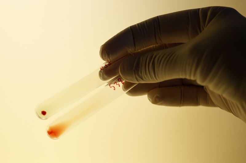 Health Rounds: Scientists change kidney blood type, a potential advance for transplant recipients-