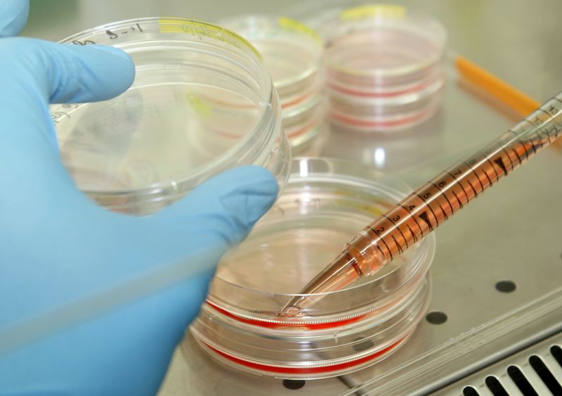 Health Rounds: Experimental Jasper drug helps stem cell transplant patients avoid toxic chemotherapy in tiny trial-