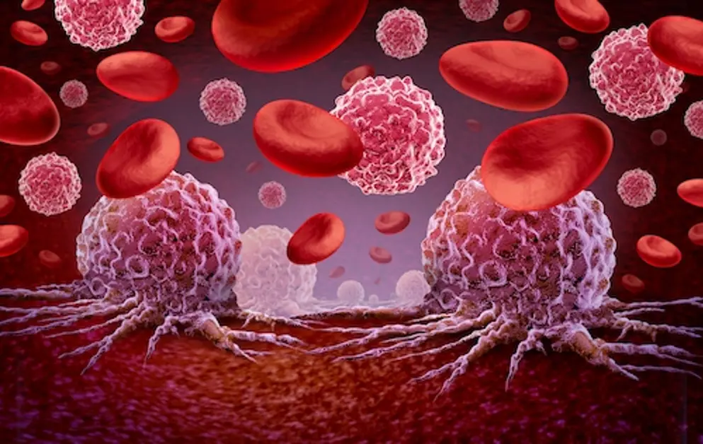 Digital image of leukamia and cancer cells in the blood.