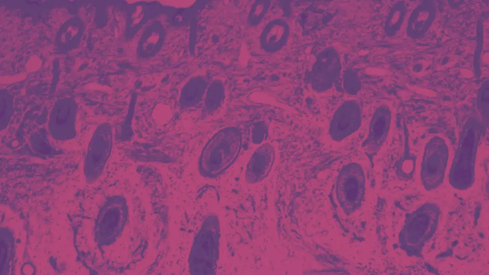Cross section human skin tissue under microscope, pink and purple colours
