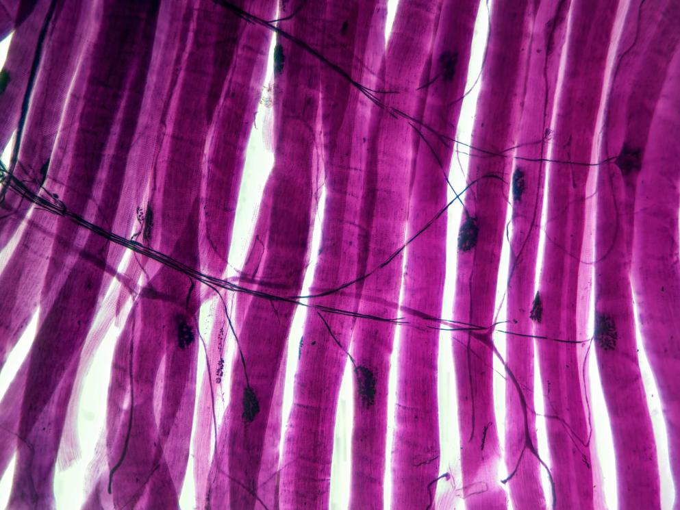 Histology microscope image of motor unit synapse of muscle fibers (100x)