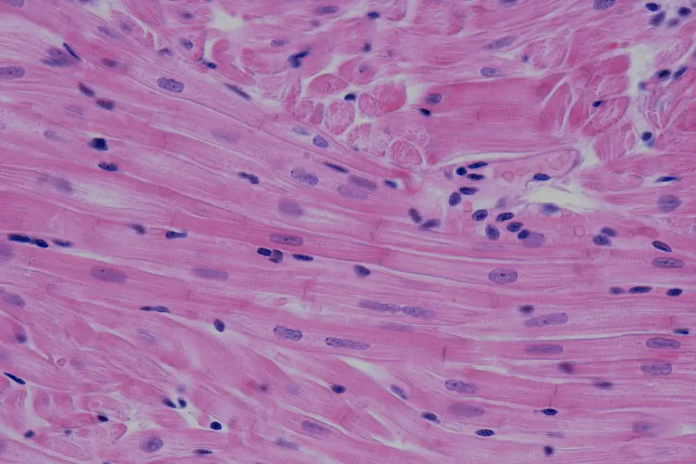 Myocardium Cardiac muscle fibers banner image