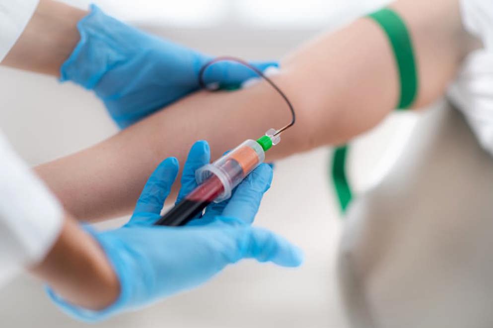 patient receiving Platelet Rich Plasma Treatment