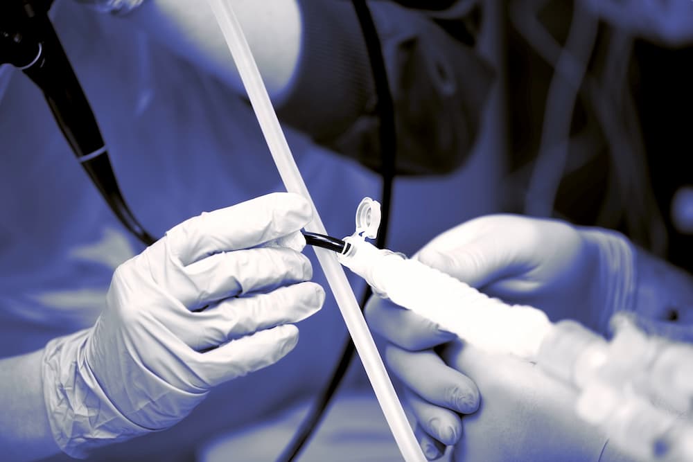 Bronchoscopy