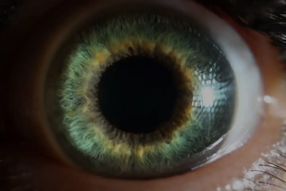 AdobeStock_471230796 Green eye biosimilars retinal disease teaser tile