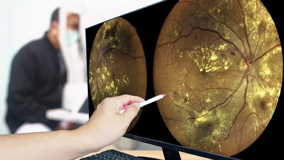 eye exam screen display, clinical practise, banner