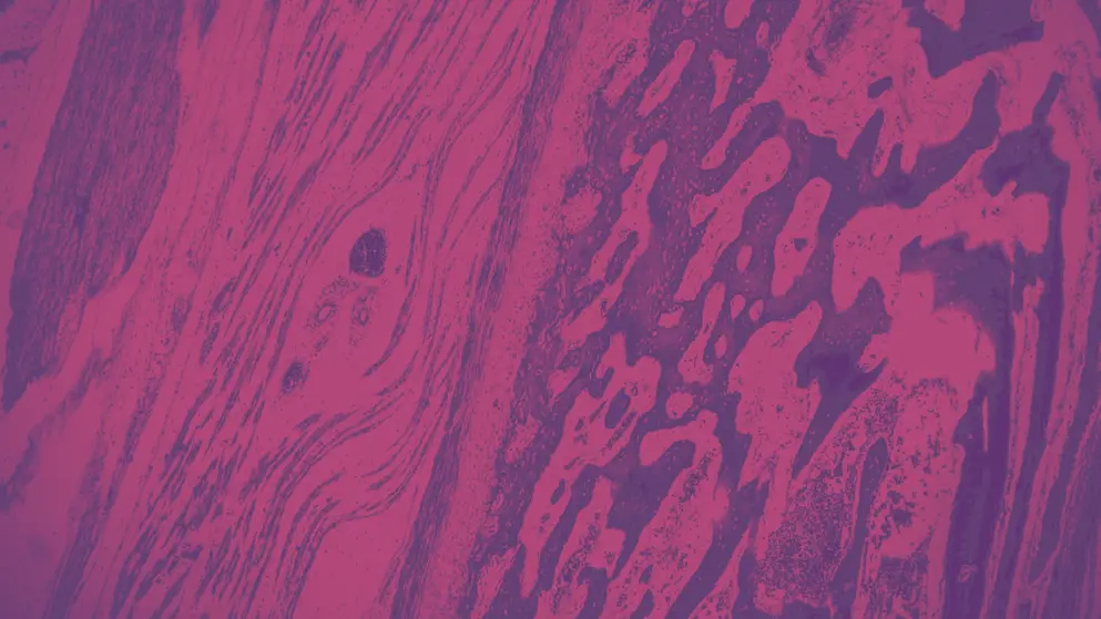Hyaline cartilage, Elastic cartilage and Bone Human under the microscope, cell image, pink and purple colours