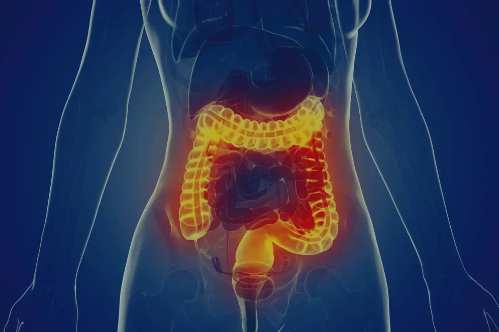 3d rendered medically accurate illustration of a woman's large intestine