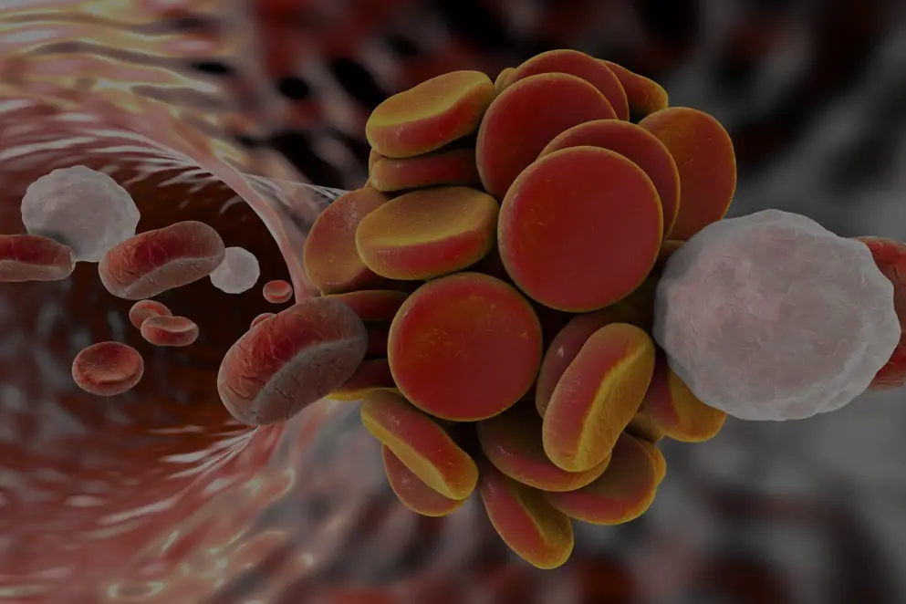 Oral Anti Coagulation Reversal