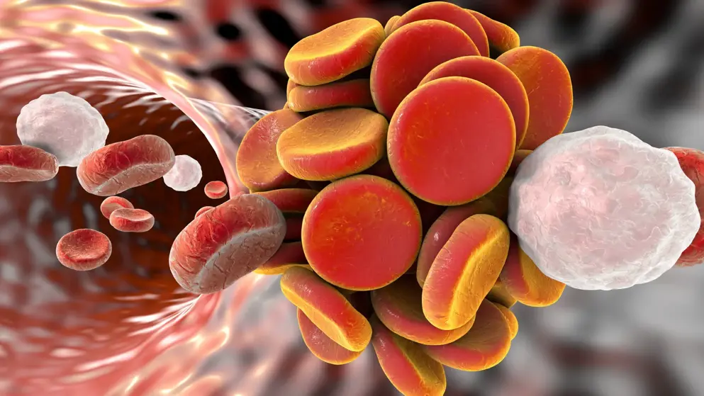 Oral Anti Coagulation Reversal