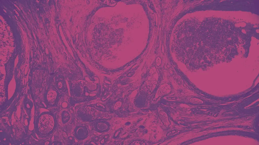 Ovary under the microscope, cell image, pink and purple