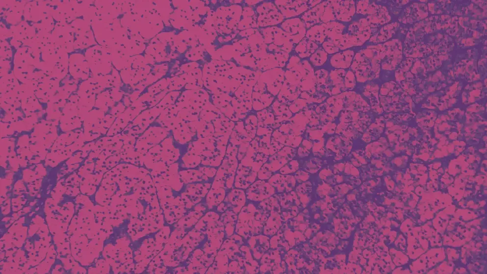 Adrenocortical Micrograph, pink and purple colours