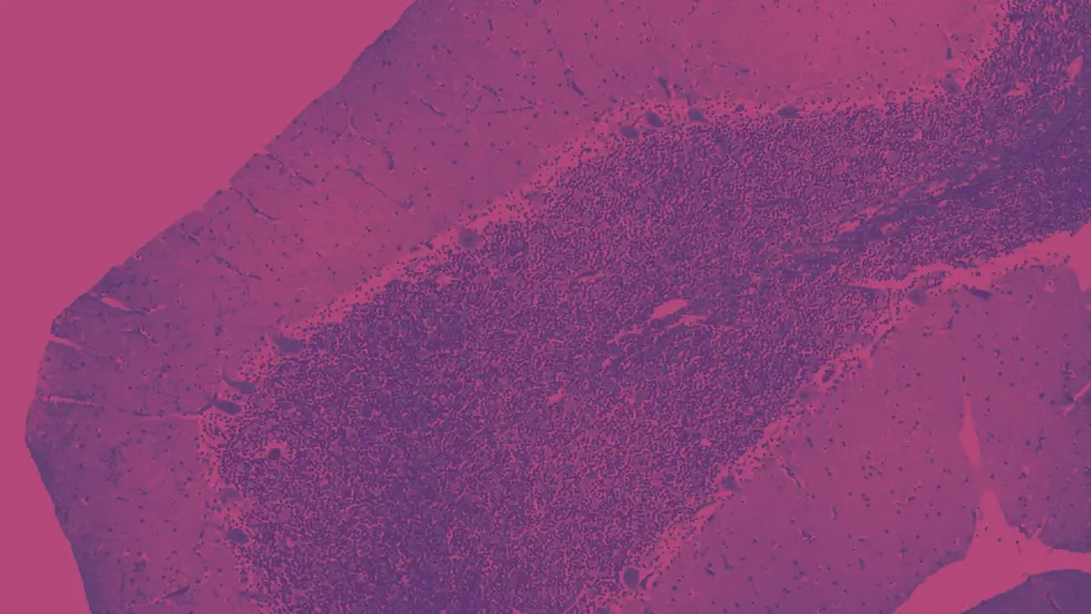 cerebellar cortex under microscope, pink and purple colours