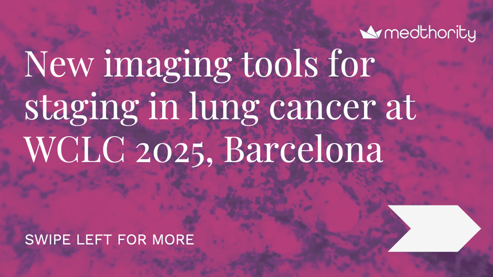 Title slide displaying the text "New imaging tools for staging in lung cancer at WCLC 2025, Barcelona.” A swipe-left prompt indicates more slides are available.
