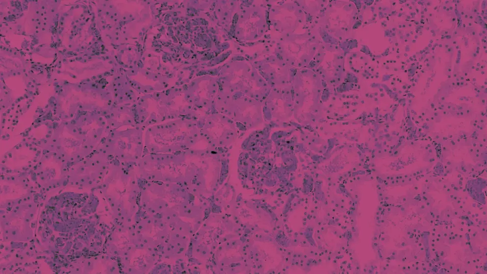 Renal congestion, cellular image, pink and purple
