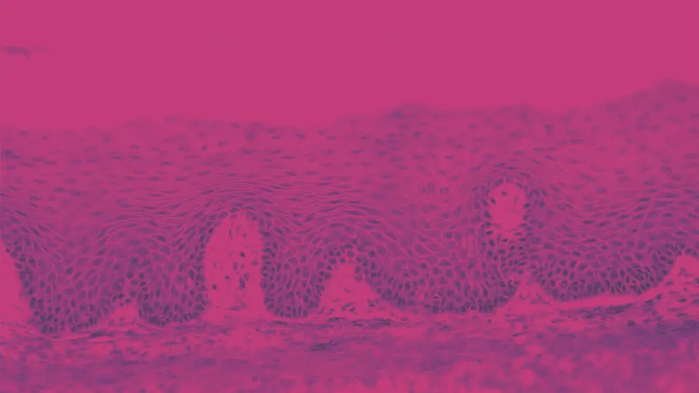 Micrograph of human skin cells rendered in pink and purple