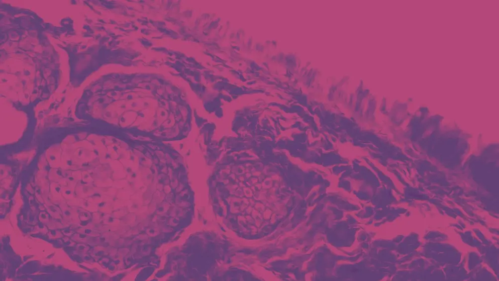Tissue of Optic nerve under microscope, pink and purple colours