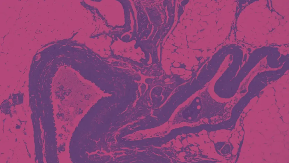 Human nervous system under the microscope, pink and purple colours