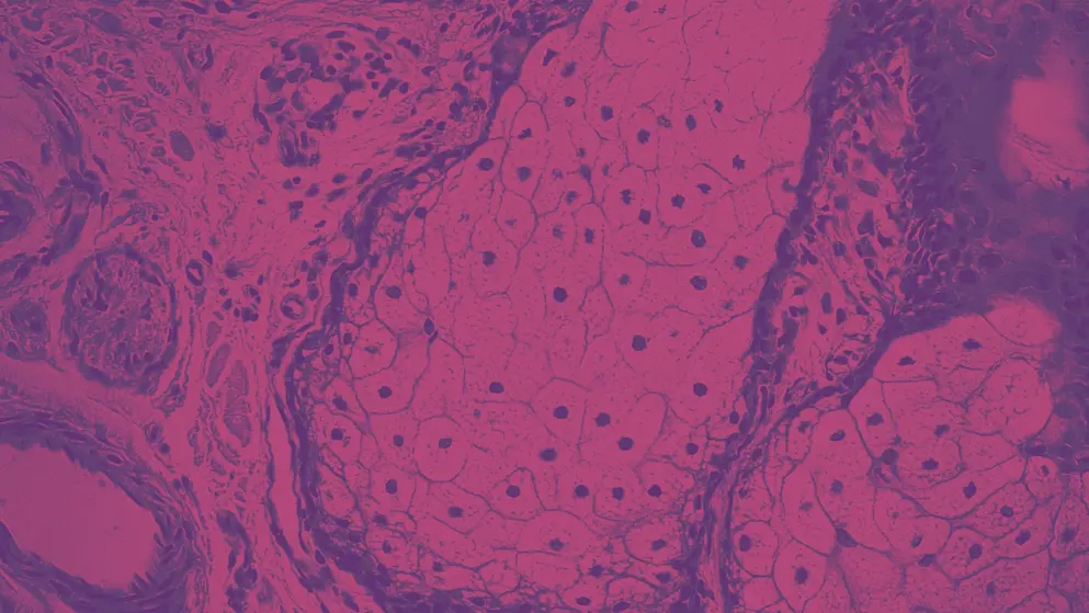 Sebaceous gland under microscope, pink and purple colours