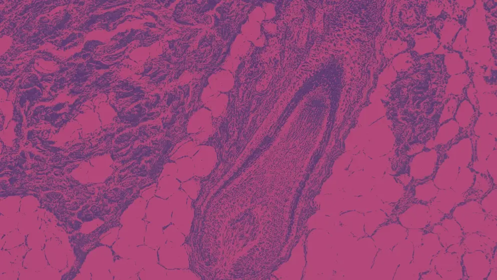 Scalp and hair follicles of human under the microscope, pink and purple colours