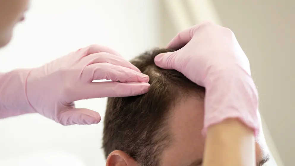 HCP checking the scalp, male patient