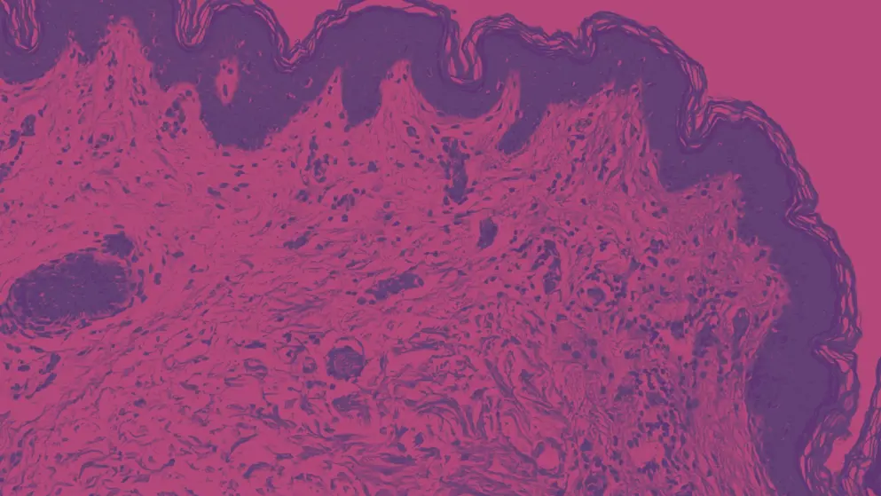 Thin skin, cellular image, pink and purple