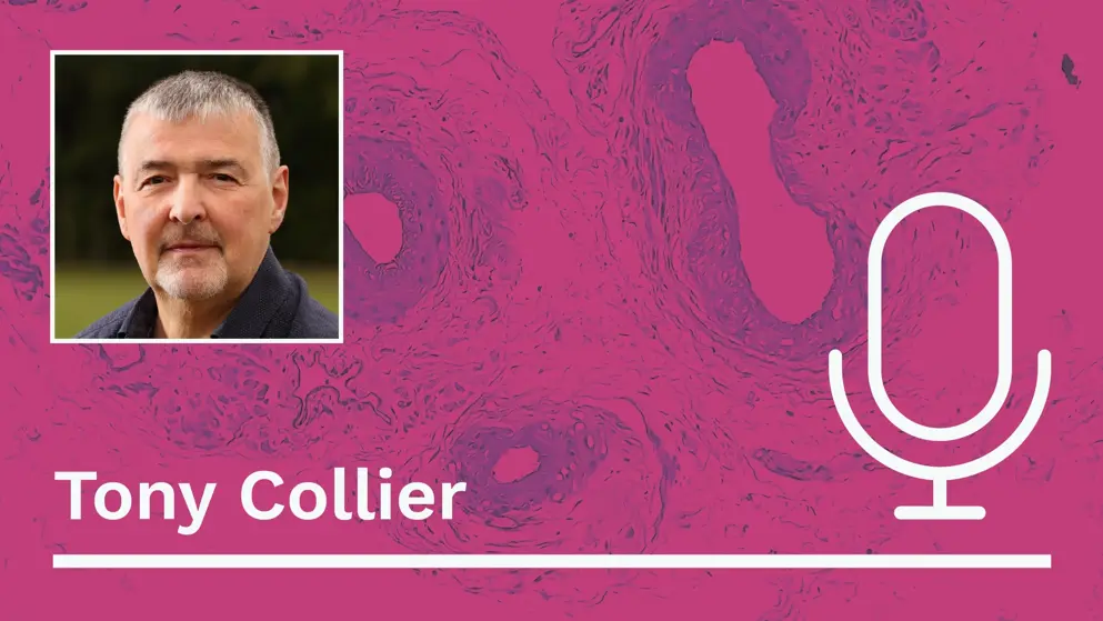 A professional headshot of Tony Collier is displayed on a pink background with a white outline of a microphone to the right. The text “Tony Collier” is written in white below the headshot.