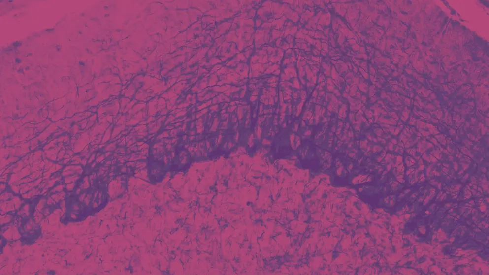 Cerebellum Purkinje cells, cellular image, pink and purple