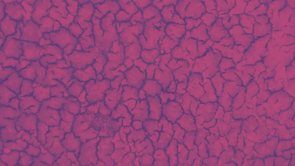Coagulated blood micrograph, cell image, pink and purple colours