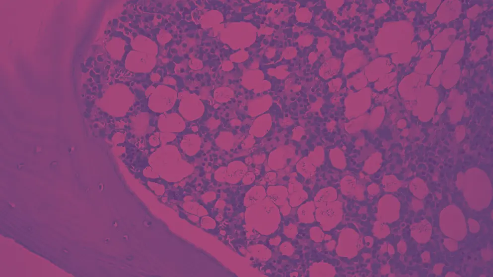 Bone marrow core biopsy, cell image, pink and purple