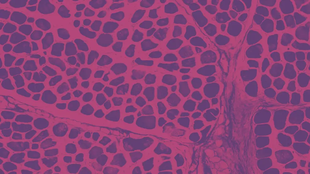 Adipose tissue, skeletal muscle, cell image, pink and purple