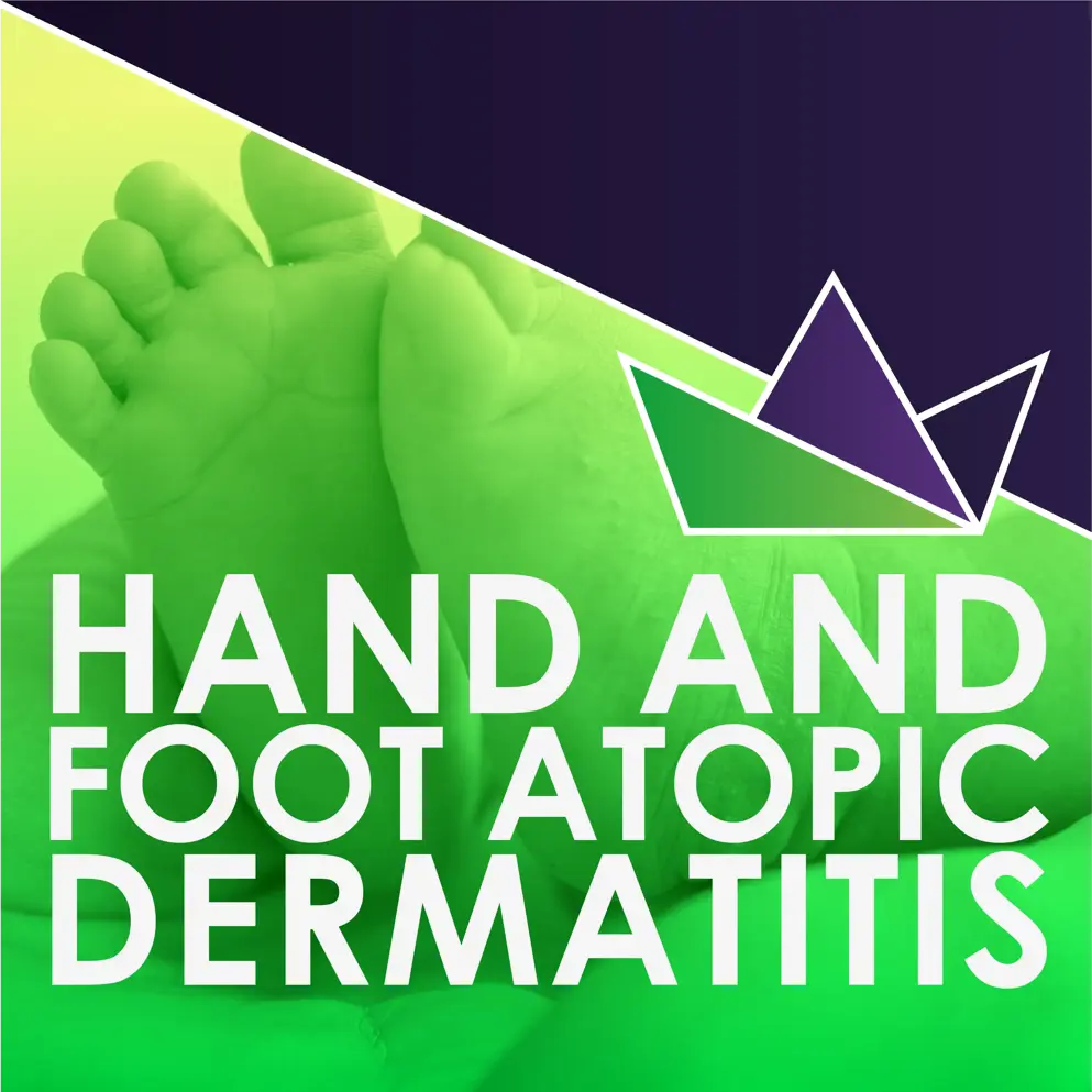 Hand and foot atopic dermatitis