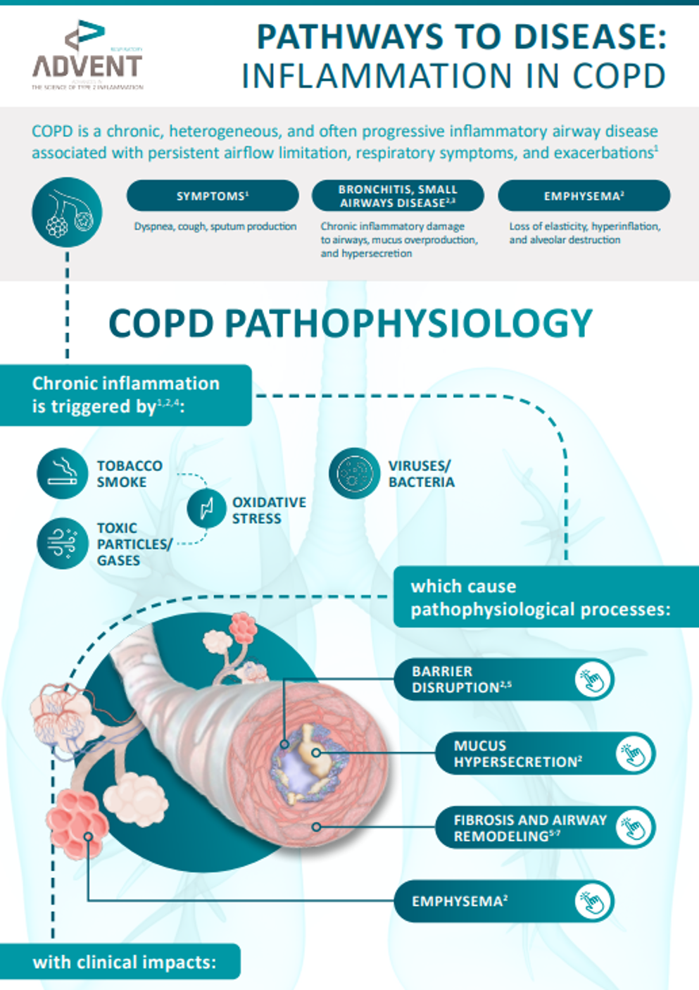 Pathways to Disease: Inflammation in COPD