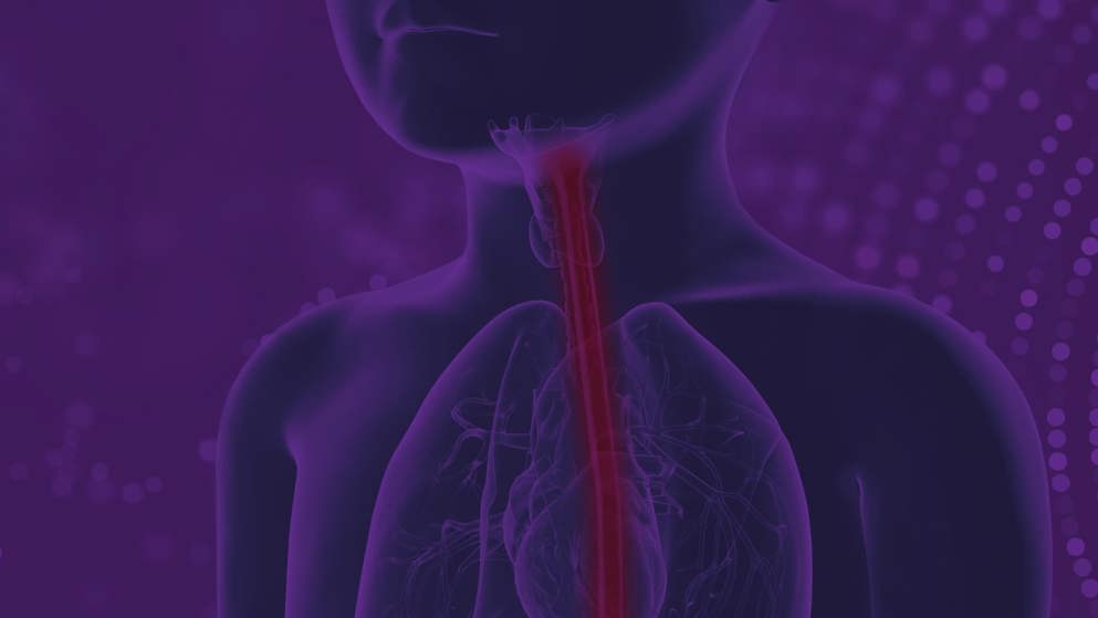 Pediatric Eosinophilic Esophagitis teaser image