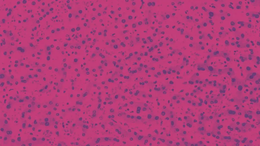 Light micrograph of a human liver stained with hematoxylin and eosin. The hepatocytes are arranged in cords separated by clear areas where hepatic sinusoids showing red blood cells are located.