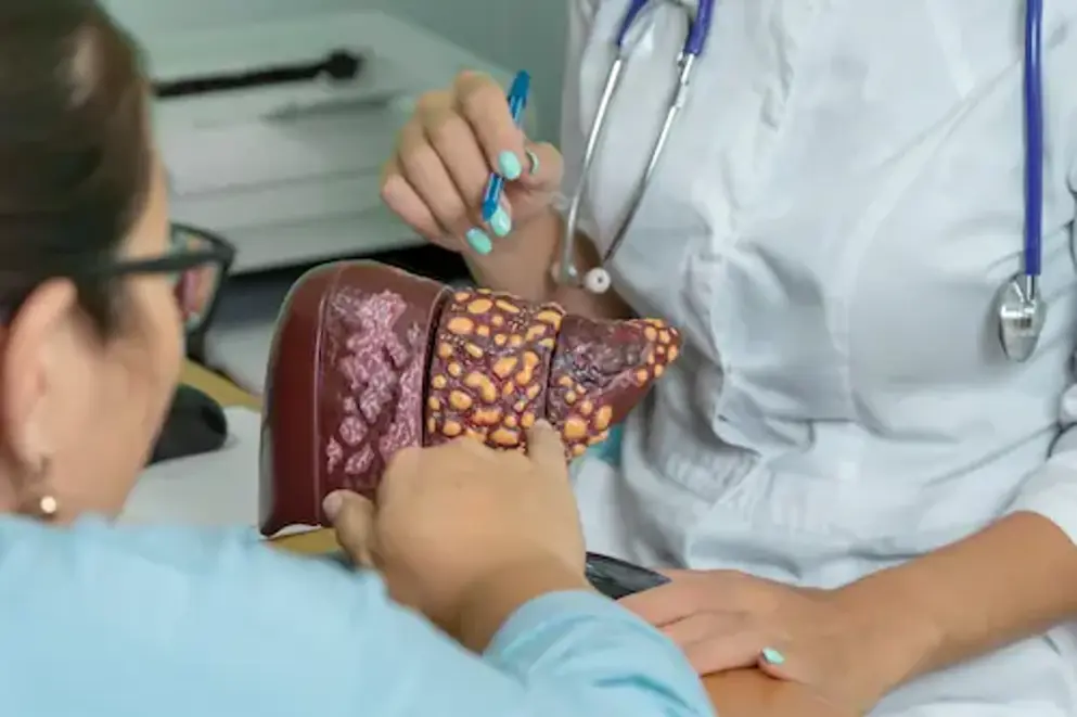 Patient at doctor's appointment points to a model of the liver while the doctor talks about the 4 stages of development of cirrhosis.