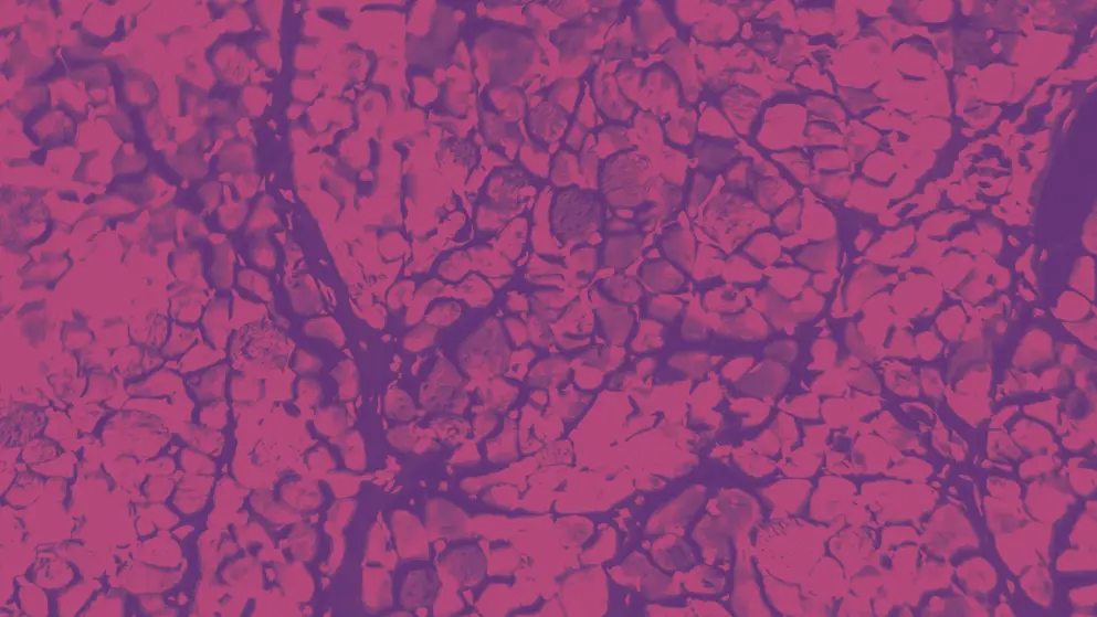 Cross-section of skeletal muscle. Photo under microscope. Pink and Purple colours