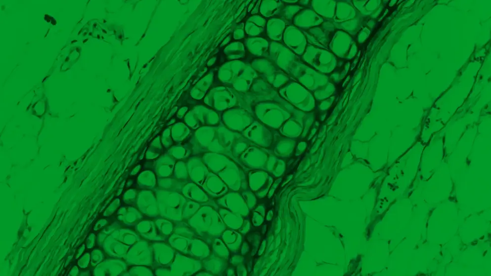 Non-specific human tissue micrograph rendered in green