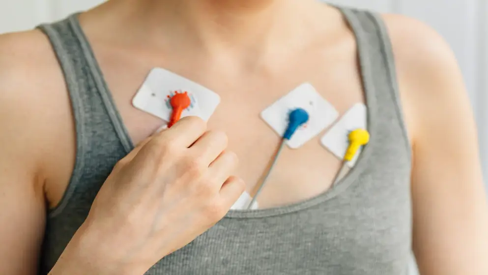 Woman with arrhythmia being monitored with an ECG