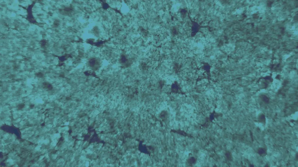 Histology microscope image of astrocytes, cell image, blue overlay