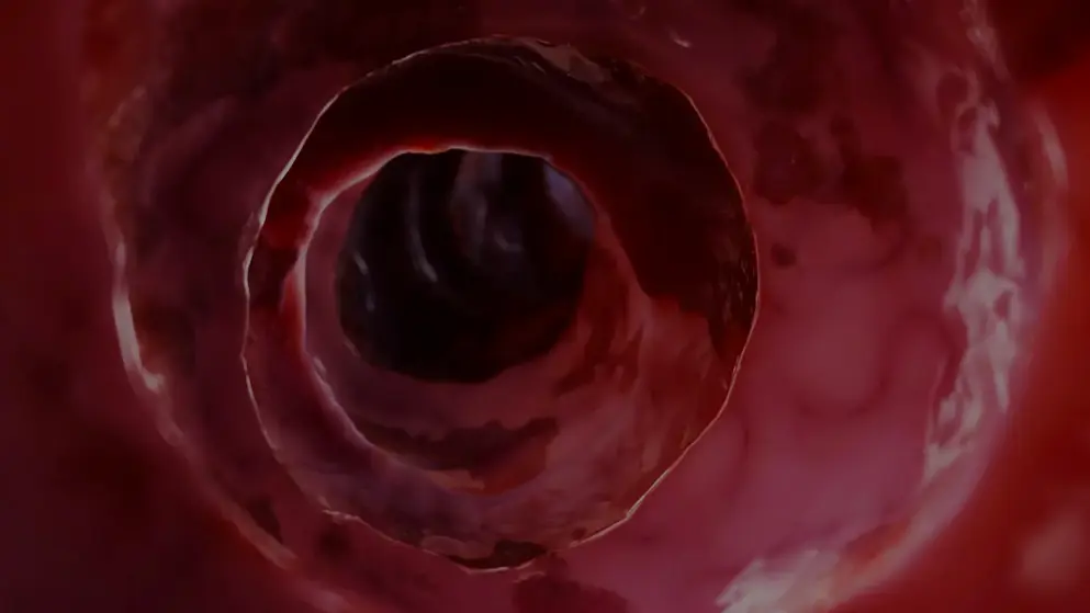 Digital image of the inside of an irritated human bowel