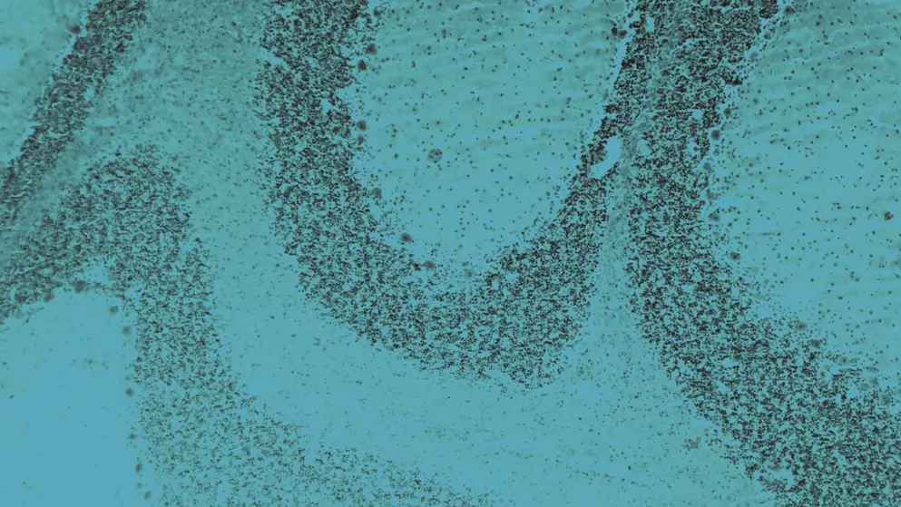 Cerebellum cross section tissue under the light microscope, cell image, blue overlay