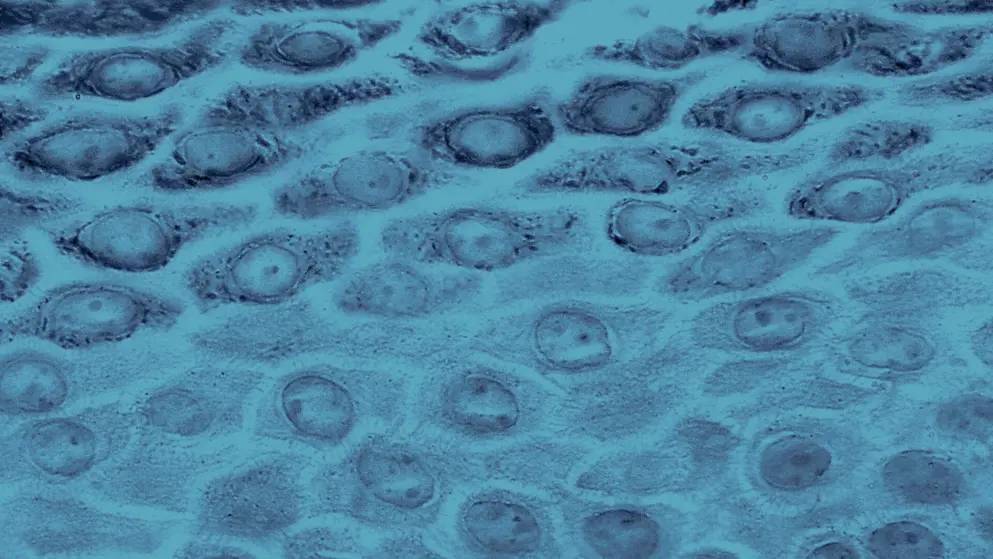 Cellular image of Epidermis, blue overlay