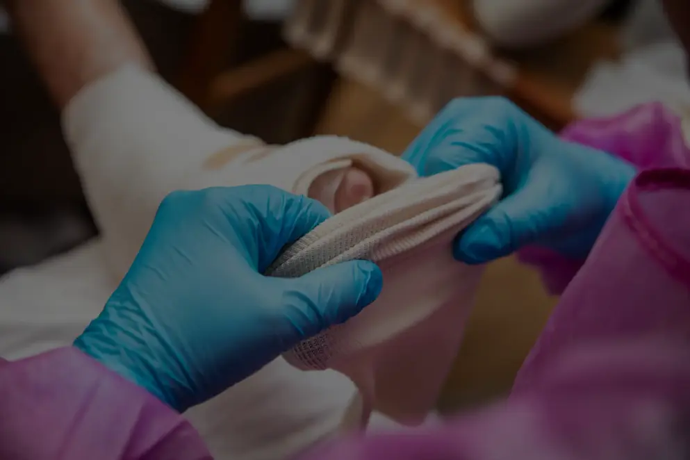 Image of a foot with epidermolysis bullosa being wrapped in soft bandages