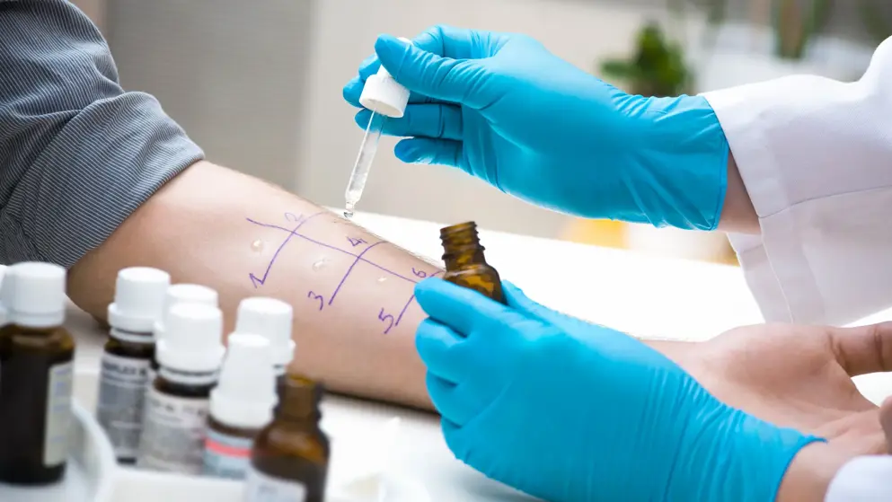 The underside of a person's forearm, split into a grid with pen marks; a doctor drips a solution into each segment; a skin prick test