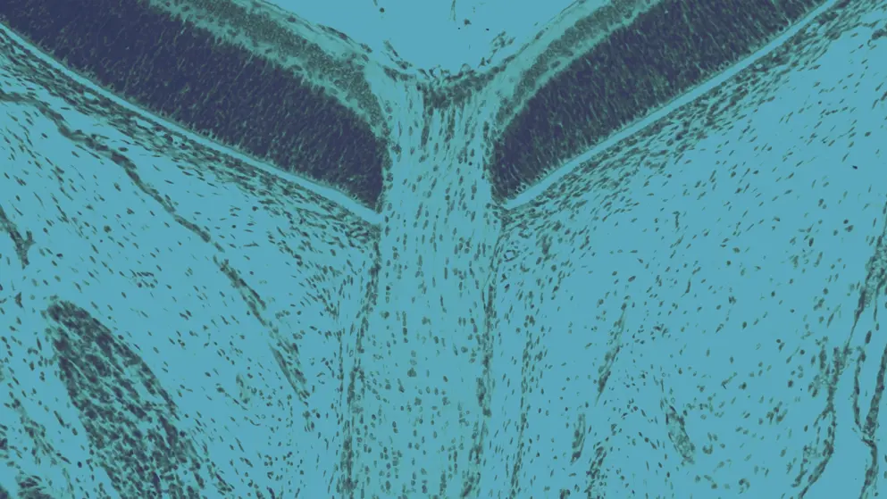 Optic Nerve, cellular image, blue overlay