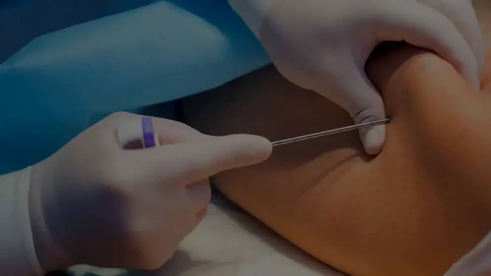 Close up of a lumbar puncture; spinal needle; white gloves