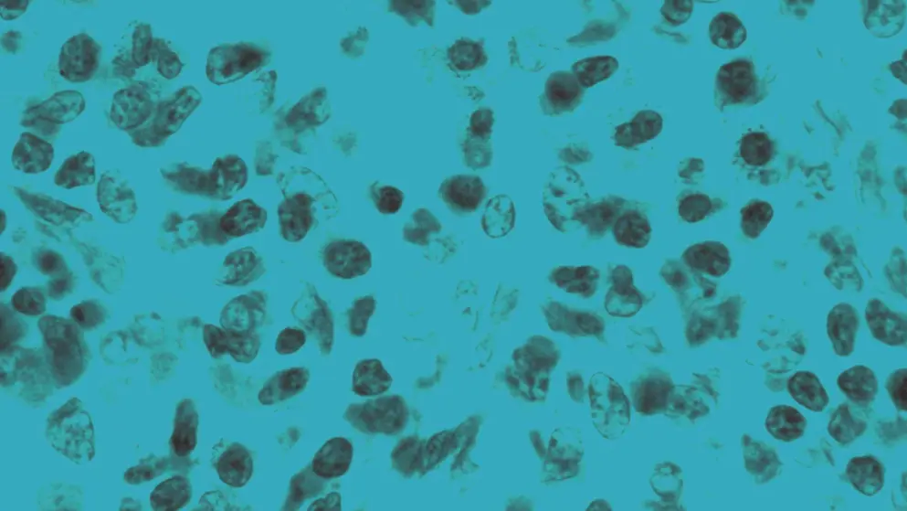 Human appendix eosinophils, cellular image, blue overlay