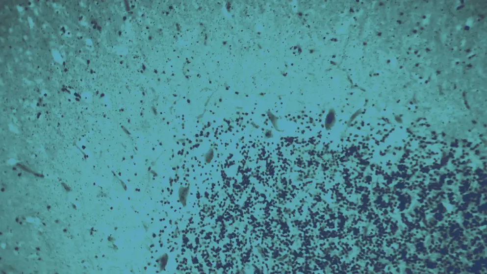 Human motor cortex, cell image, blue overlay